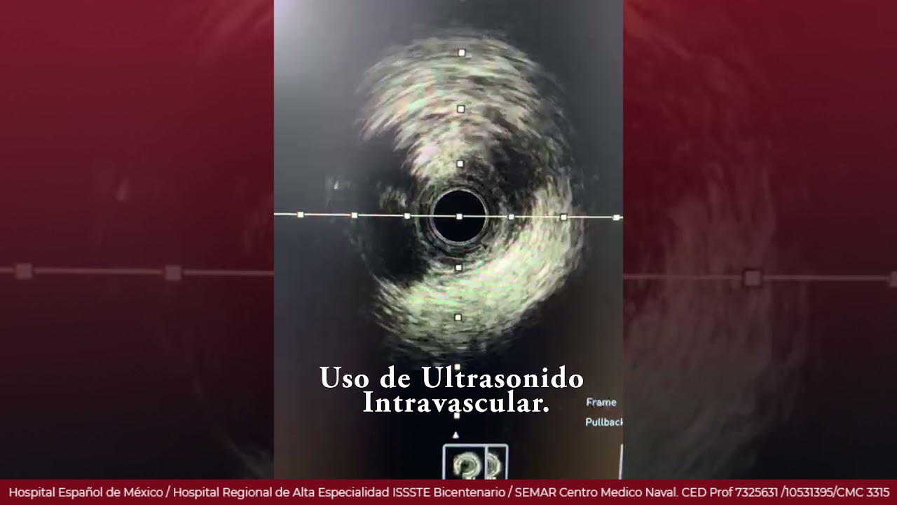 Marcelo Utrera Lagunas-109