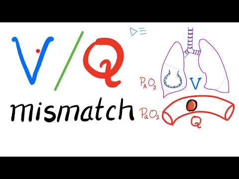 Ventilation/ Perfusion Ratio (V/Q) and V/Q Mismatch - Respiratory Physiology & Pulmonology