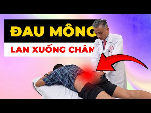 Đau Mông Lan Xuống Chân Khiến Bạn Mất Ngủ? Bác Sĩ Chỉ Cách Chấm Dứt Cơn Đau