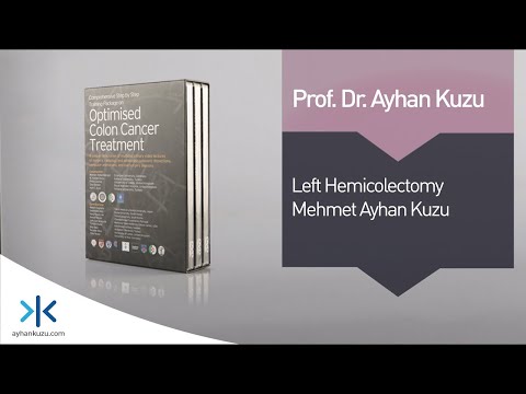 2.2.6. Left Hemicolectomy for Locally Advanced Sigmoid Carcinoma - M. Ayhan Kuzu