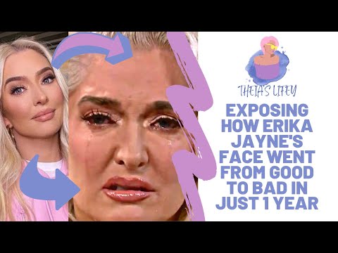 Exposing: How Erika Jayne's Face Went From Good To Bad In Just 1 Year (Secrets Revealed)