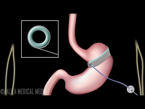 Physiology Basics the Digestive System Animation