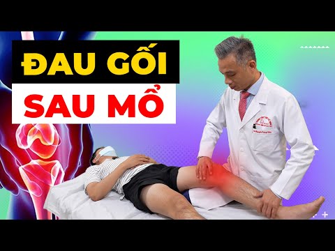 Tại Sao Gối Vẫn Đau Sau 1 Năm Phẫu Thuật? Bác Sĩ Tiết Lộ Nguyên Nhân Chính