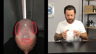 Do I Shave My Head To Make My First Template For A Hair System Or Hair Replacement? Watch This First