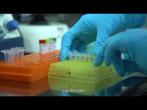 SOP of Wondfo 2019-nCoV Real-Time RT-PCR Assay