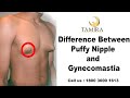 Puffy Nipple Vs Gynecomastia L Dr Jayanthy Ravindran From Tamiralife Chennai