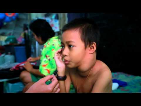 สายตาขยายขนาดหน้าอก ประทับตราเล็ก ๆ ใต้ผิวหนังบนหน้าอก