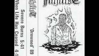 Nihilist- Severe Burns (Rare 'Drowned' Demo '89)