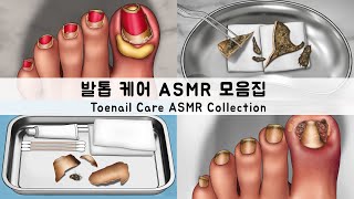 ASMR 내성발톱 치료 애니메이션 모음집 발톱 스케일링 INGROWN TOENAIL TREATMENT COLLECTION Toenail Scaling