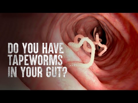 How to Survive Tapeworms (Warning: distressing footage)