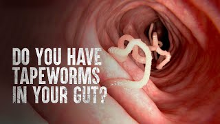 How to Survive Tapeworms (Warning: distressing footage)