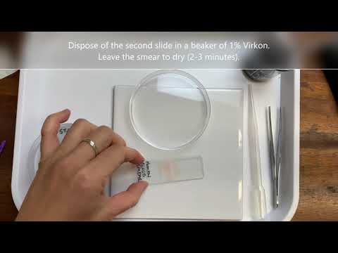 Making a human blood smear and staining using Quink - Video