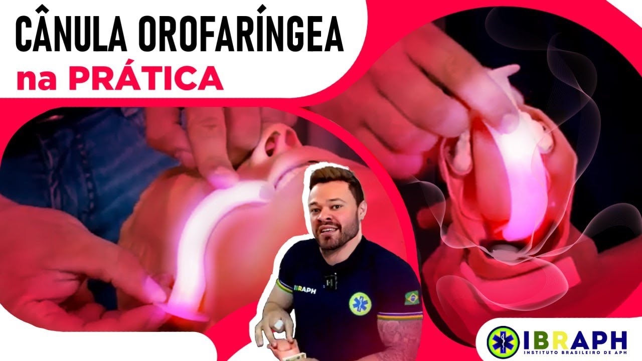 Uso da Cânula Orofaríngea na PRÁTICA (Ex. Cânula de Guedel)