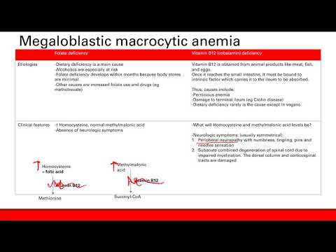 Macrocytic anemia | Hematology | Step 1 Simplified