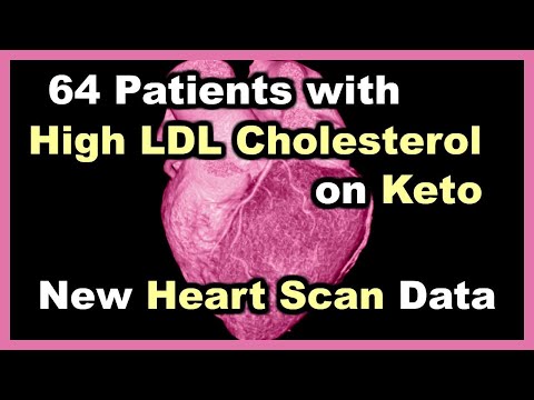 New Heart Scan Data for 64 Participants with high LDL Cholesterol on a Ketogenic Diet