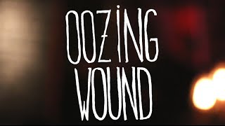 Oozing Wound - Live at le Sonic