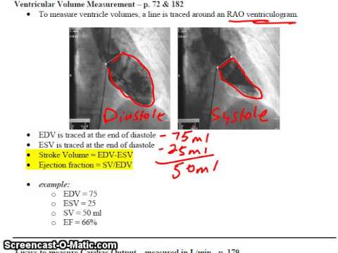 Stroke Volume and Angiographic CO