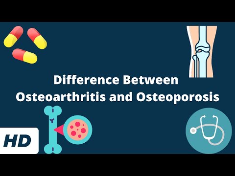 Frozen Shoulder Causes Signs and Symptoms Diagnosis and Treatment