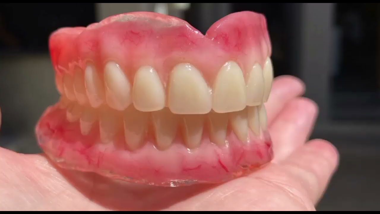 Acrilização e Acabamento de Prótese Total