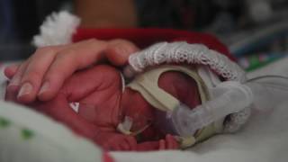 NICU nurses sing holiday carol to preemie baby