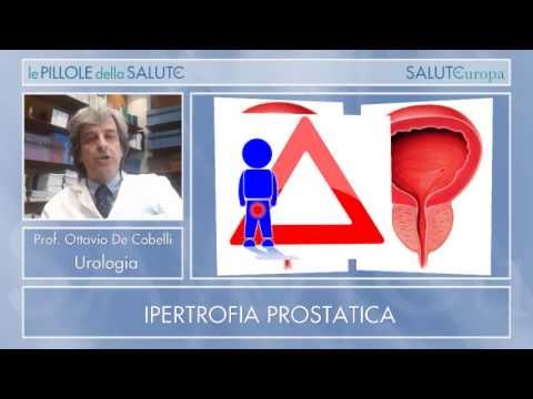 Segni ecografici di prostatite Benigna prostatica displasia