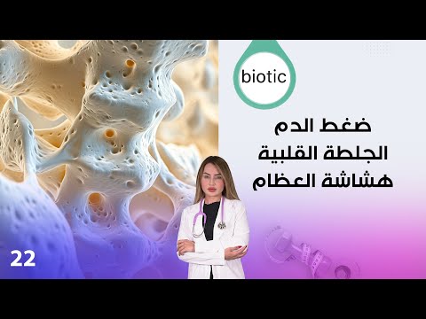 فيديو | ضغط الدم، الجلطة القلبية، هشاشة العظام - م٤ Biotic - الحلقة ٢٢