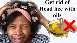 HOW TO GET RID OF HEAD LICE PERMANENTLY with THESE OILS! Treat HEAD LICE NATURALLY at HOME
