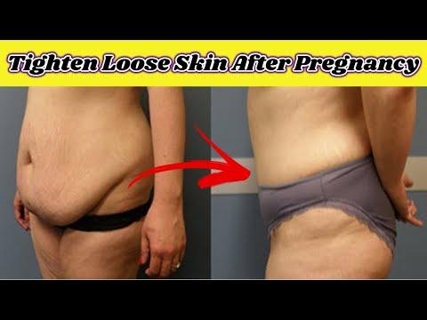 Pagkain sa panahon ng dibdib-pagpapakain kung paano mangayayat Jess plus at slimming