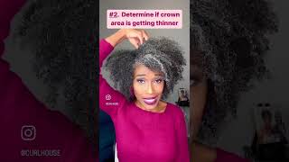 EXAMINE YOUR SCALP #shortsvideo