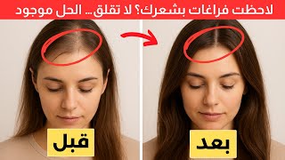10 طرق طبيعية لإعادة إنبات الشعر وكثافته |  بدون أدوية أو كيماويات