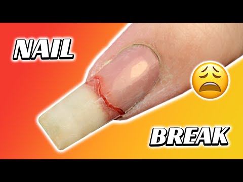 How to repair a broken nail | Nail break