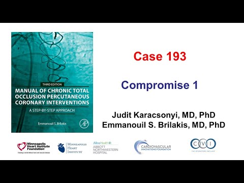 Case 193: Manual of CTO PCI - Compromise 1