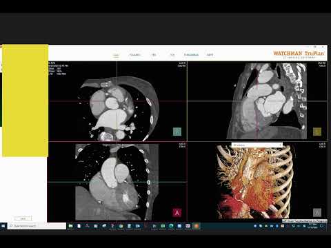 TruPlan Watchman Planning Software Tutorial