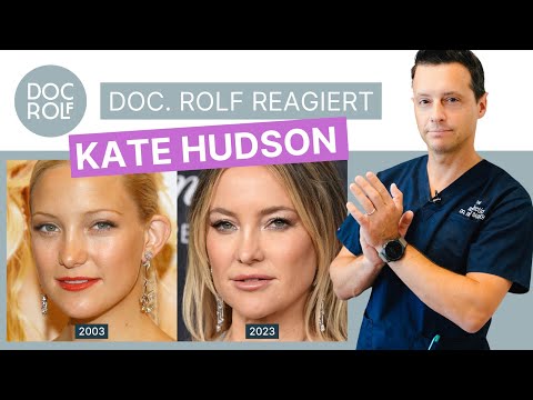 Sind KATE HUDSONS Lippen aufgespritzt?! doc.rolf reagiert