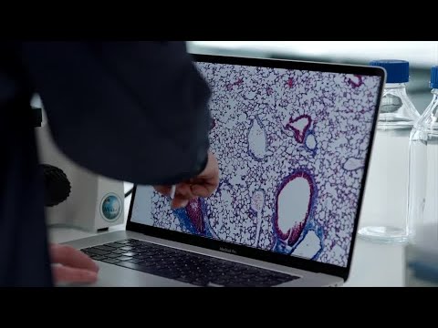 Transforming how we treat and prevent heart disease