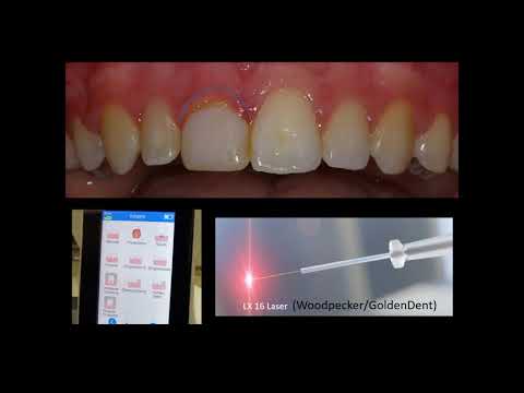 Jak wykorzystać stomatologię laserową w swojej praktyce?