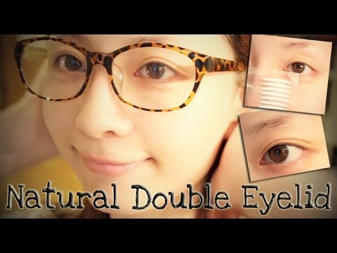 單眼皮大作戰雙眼皮成形術(視頻)