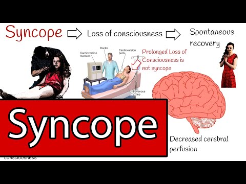 Syncope and Fainting,  Syncope Types and Treatment.    Simply explained.