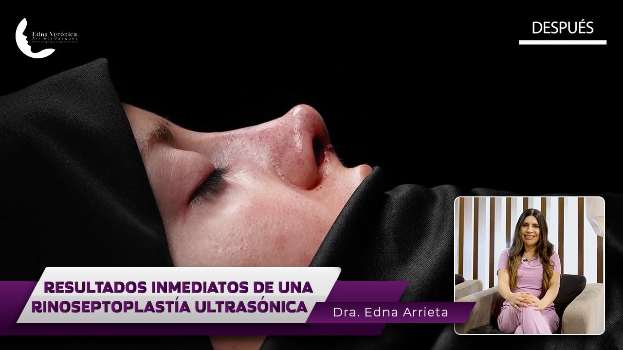 Edna Verónica Arrieta Vázquez-47