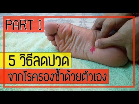 Enalapril ในโรคสะเก็ดเงิน การรักษาเยียวยาพื้นบ้านของกลากและโรคผิวหนัง