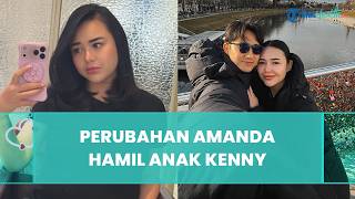 Perubahan Amanda Manopo Hamil Besar 7 Bulan, Mulai Jaga Kondisi Kandungan dan Batasi Aktivitas