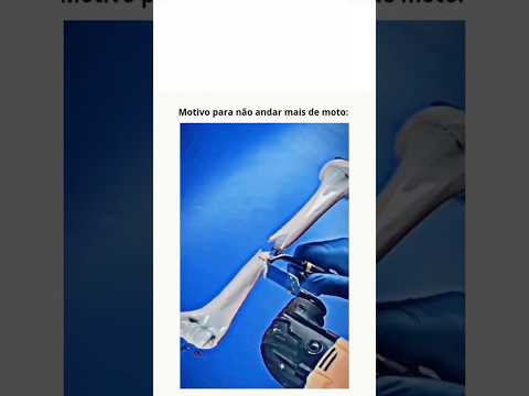 Motivo pra não andar de moto!!🤯