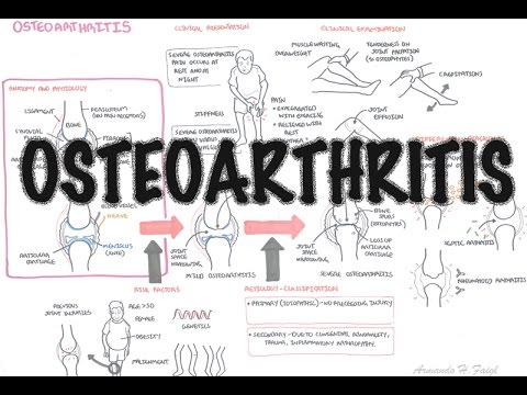 Visión general de la osteoartritis (causas, fisiopatología, investigaciones, tratamiento)