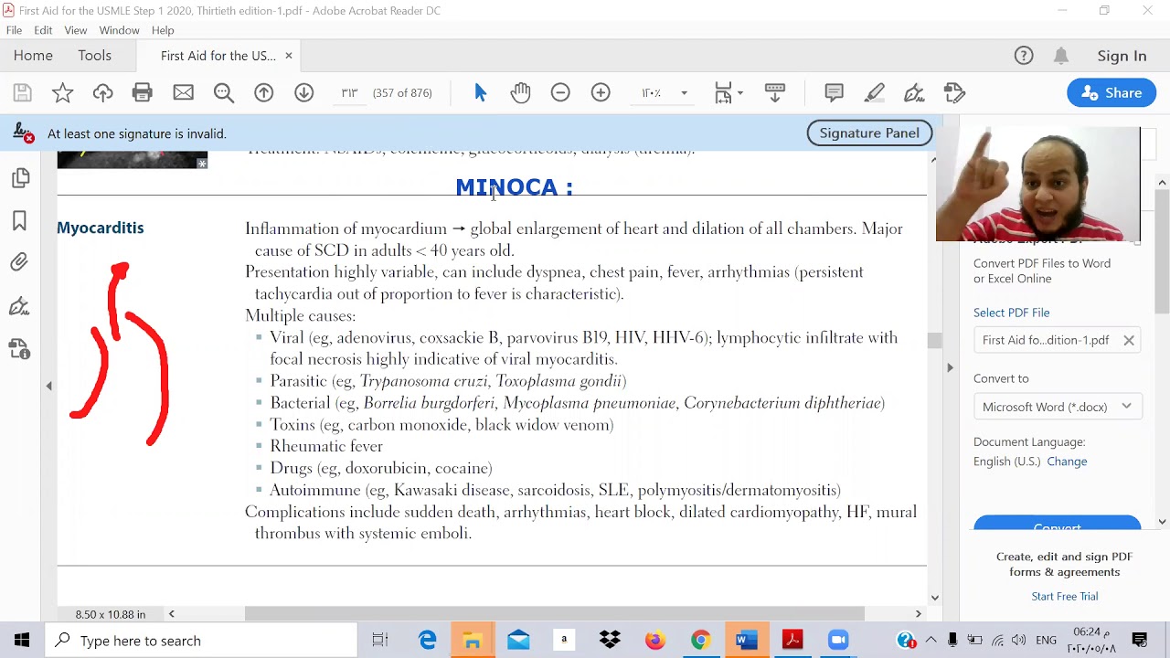 معادلة امريكية بالعربي Toxic USMLE ( CVS miscellaneous B) Ibrahem gamalابراهيم جمال myocarditis
