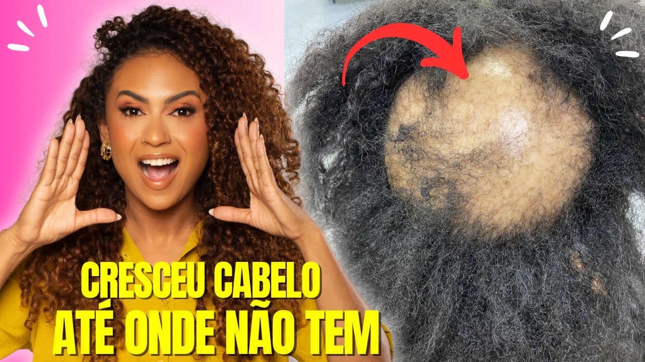 SEGREDO JAPONÊS! APENAS 2 INGREDIENTES PODEROSOS 🌿 O CABELO CRESCE INCRIVELMENTE RÁPIDO