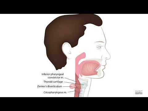 HCC 1475-2f2-Pathology of Esophagus - Zenkers diverticulum
