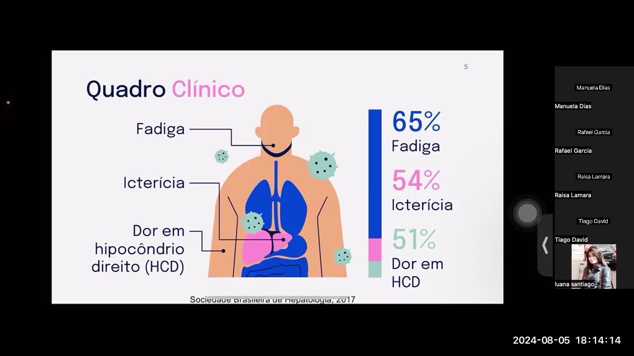 Aula Colangite Esclerosante Primária - Dra. Luana Santiago