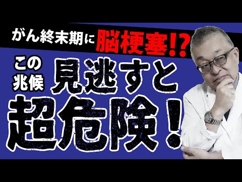 トルソーについて詳しく解説