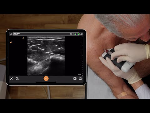 PRP Shoulder Injection