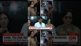 Download lagu DNA Ridwan Kamil Tidak Cocok dengan Anak Lisa Mariana mp3 Download lagu DNA Ridwan Kamil Tidak Cocok dengan Anak Lisa Mariana mp3